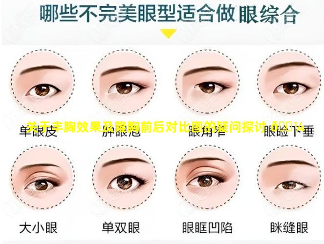 关于丰胸效果及隆胸前后对比图的疑问探讨 🌼